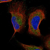 Anti-MAP1LC3B Antibody