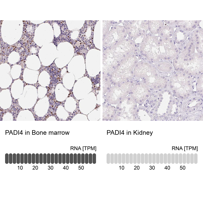 Anti-PADI4 Antibody
