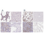 Immunohistochemical staining of human bone marrow, liver, spleen and testis using Anti-PADI4 antibody HPA042825 (A) shows similar protein distribution across tissues to independent antibody HPA017007 (B).