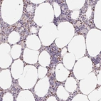 Immunohistochemical staining of human bone marrow shows high expression.
