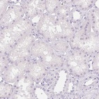 Immunohistochemical staining of human kidney shows low expression as expected.