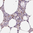 Immunohistochemical staining of human bone marrow using Anti-PADI4 antibody HPA042825.