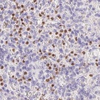 Immunohistochemical staining of human spleen using Anti-PADI4 antibody HPA042825.