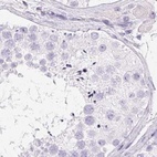 Immunohistochemical staining of human testis using Anti-PADI4 antibody HPA042825.