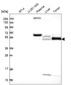 Western blot analysis in human cell line RT-4, human cell line U-251 MG, human plasma, human liver tissue and human tonsil tissue.