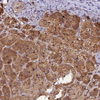 Anti-PEX3 Antibody