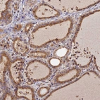 Immunohistochemical staining of human thyroid gland shows strong granular cytoplasm positivity in glandular cells.