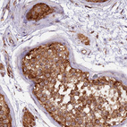 Immunohistochemical staining of human testis shows strong granular cytoplasm positivity in cells in seminiferous ducts and Leydig cells.