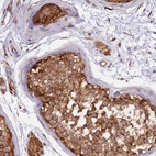 Immunohistochemical staining of human testis shows strong granular cytoplasm positivity in cells in seminiferous ducts and Leydig cells.