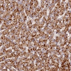 Immunohistochemical staining of human liver shows strong granular cytoplasm positivity in hepatocytes.