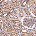 Immunohistochemical staining of human kidney shows strong granular cytoplasm positivity in cells in tubules.