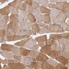 Immunohistochemical staining of human skeletal muscle shows moderate granular cytoplasm positivity in myocytes.
