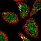 Immunofluorescent staining of human cell line A-431 shows localization to nucleoplasm & peroxisomes.
