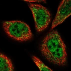 Immunofluorescent staining of human cell line A-431 shows localization to nucleoplasm & peroxisomes.