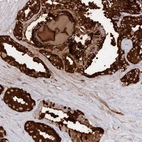 Immunohistochemical staining of human seminal vesicle shows high expression.