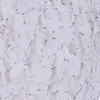 Immunohistochemical staining of human skeletal muscle shows low expression as expected.