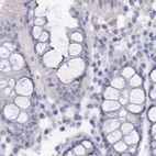 Immunohistochemical staining of human colon using Anti-SEMG2 antibody HPA042835.