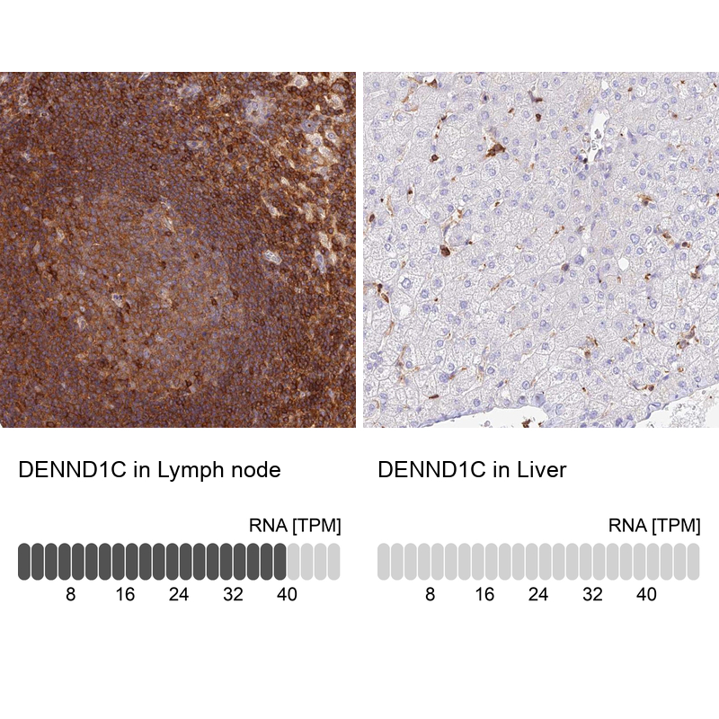Anti-DENND1C Antibody