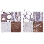 Immunohistochemical staining of human bone marrow, colon, liver and lymph node using Anti-DENND1C antibody HPA042839 (A) shows similar protein distribution across tissues to independent antibody HPA042758 (B).