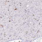 Immunohistochemical staining of human liver shows low expression as expected.