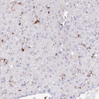 Immunohistochemical staining of human liver shows low expression as expected.