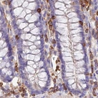 Immunohistochemical staining of human colon using Anti-DENND1C antibody HPA042839.