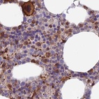 Immunohistochemical staining of human bone marrow using Anti-DENND1C antibody HPA042839.