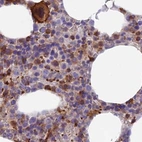 Immunohistochemical staining of human bone marrow using Anti-DENND1C antibody HPA042839.