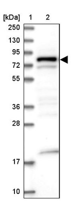 Lane 1: Marker [kDa] 250, 130, 95, 72, 55, 36, 28, 17, 10_br/_Lane 2: Human cell line RT-4