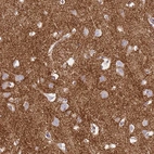 Immunohistochemical staining of human cerebral cortex shows strong cytoplasmic positivity in neuropil.