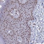Immunohistochemical staining of human skin shows strong nuclear positivity in squamous epithelial cells.