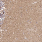 Immunohistochemical staining of human cerebellum shows moderate cytoplasmic positivity in neuropil.