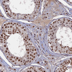 Immunohistochemical staining of human testis shows strong nuclear positivity in cells in seminiferous ducts and leydig cells.