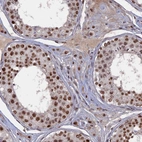 Immunohistochemical staining of human testis shows strong nuclear positivity in cells in seminiferous ducts and leydig cells.