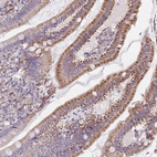 Immunohistochemical staining of human duodenum shows moderate cytoplasmic granular positivity in glandular cells.