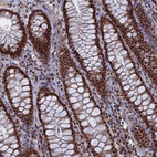 Immunohistochemical staining of human rectum shows strong nuclear positivity in glandular cells.