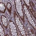 Immunohistochemical staining of human rectum shows strong nuclear positivity in glandular cells.
