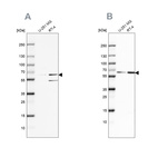 Western blot analysis using Anti-SF3A2 antibody HPA042843 (A) shows similar pattern to independent antibody HPA049439 (B).
