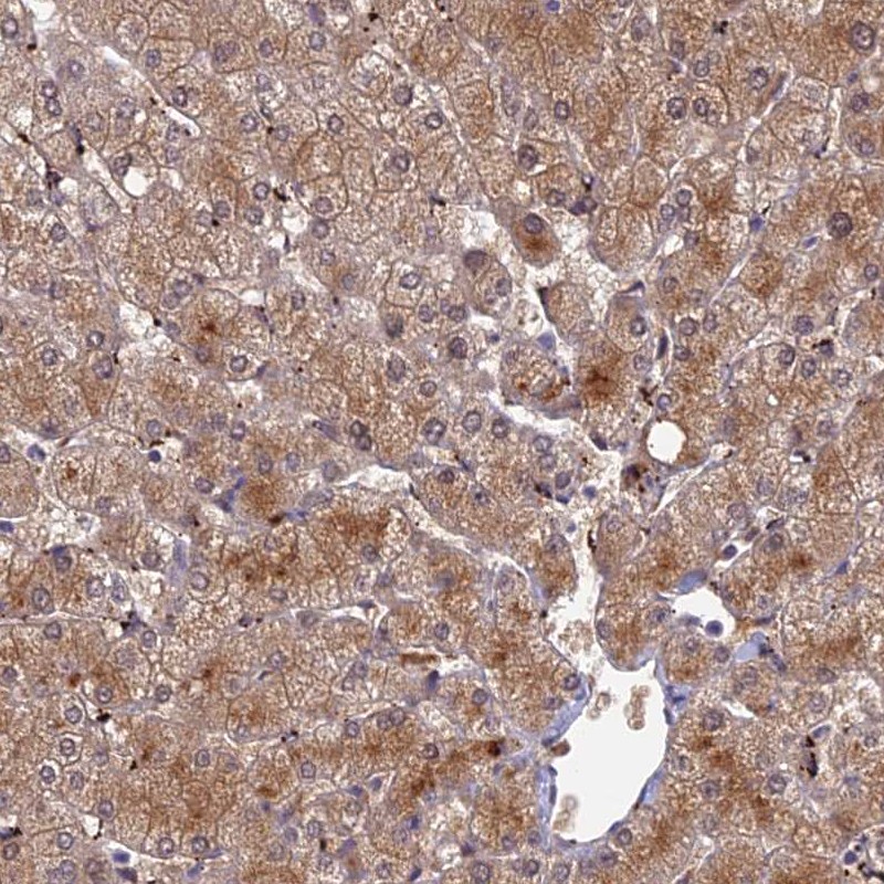 Anti-ADAMTS13 Antibody