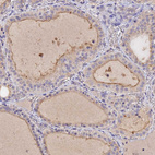 Anti-SLC26A4 Antibody