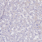 Anti-SLC26A4 Antibody