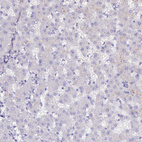 Immunohistochemical staining of human liver shows no positivity in hepatocytes as expected.