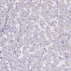 Immunohistochemical staining of human liver shows no positivity in hepatocytes as expected.