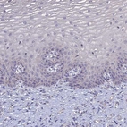 Immunohistochemical staining of human cervix shows no positivity in squamous epithelial cells as expected.