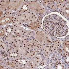 Immunohistochemical staining of human kidney shows strong nuclear positivity in cells in tubules.
