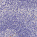 Anti-SLC26A4 Antibody