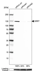 Western blot analysis in MCF-7 cells transfected with control siRNA, target specific siRNA probe #1 and #2, using Anti-SRRT antibody. Remaining relative intensity is presented. Loading control: Anti-GAPDH.