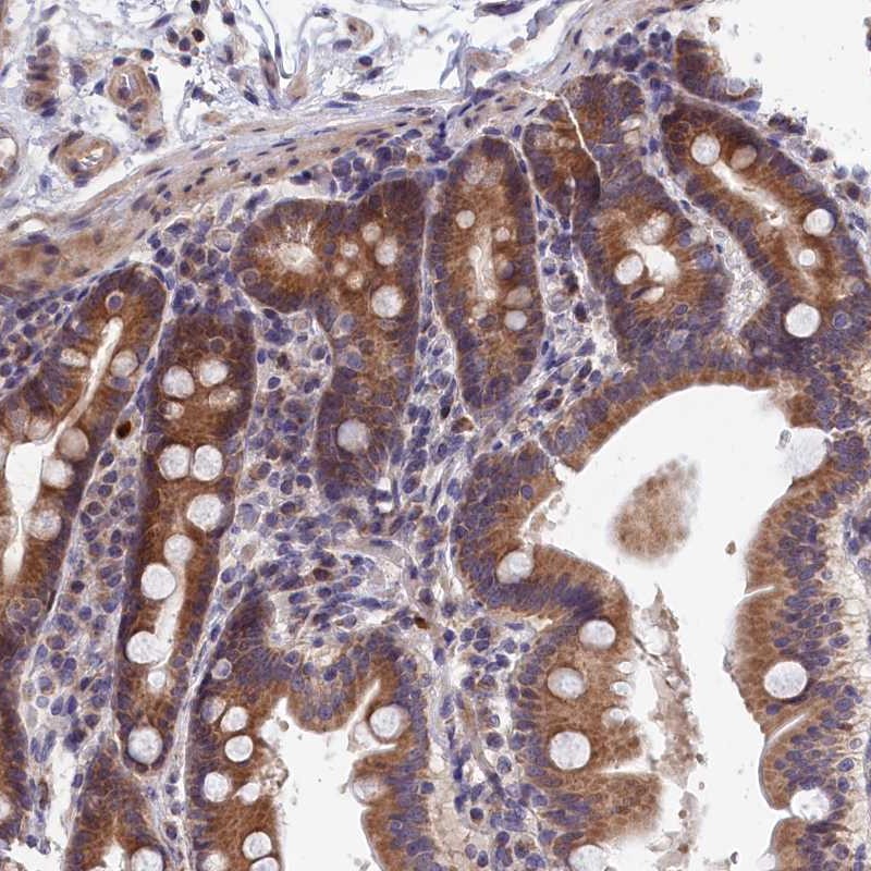 Anti-EPB41L4B Antibody