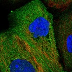 Immunofluorescent staining of human cell line A-431 shows localization to plasma membrane & cytosol.