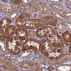 Anti-RC3H2 Antibody